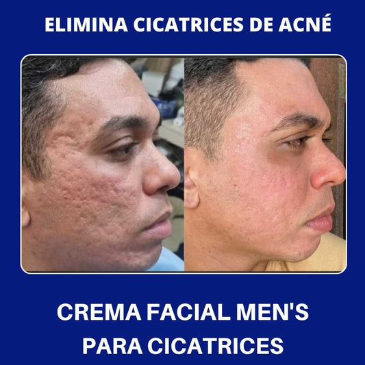 Crema Facial Mens CICATRICES